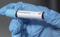 ДИАГНОЗ COVID-19 ПОДТВЕРЖДЕН У 47 ЧЕЛОВЕК