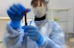 ОБЩЕЕ ЧИСЛО ВЫЯВЛЕННЫХ ЗАБОЛЕВШИХ КОРОНАВИРУСОМ В АБХАЗИИ ПРЕВЫСИЛО 53 ТЫСЯЧИ ЧЕЛОВЕКА