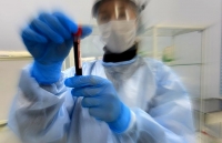 ОБЩЕЕ ЧИСЛО ВЫЯВЛЕННЫХ ЗАБОЛЕВШИХ КОРОНАВИРУСОМ В АБХАЗИИ ПРЕВЫСИЛО 53 ТЫСЯЧИ ЧЕЛОВЕКА
