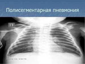 МИНЗДРАВ РА: КРАСНОДАРСКИЕ МЕДИКИ ДИАГНОСТИРОВАЛИ У БЖАНИЯ ДВУХСТОРОННЮЮ ПОЛИСЕГМЕНТАРНУЮ ПНЕВМОНИЮ