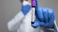 СЭС ОПРОВЕРГЛА ИНФОРМАЦИЮ О ЗАВОЗЕ COVID-19 ИЗ АБХАЗИИ В РОССИЮ