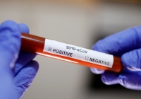 ВЫЯВЛЕНО ЕЩЕ 8 БОЛЬНЫХ COVID-19