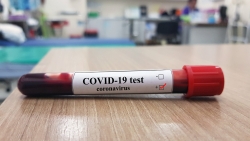 ДИАГНОЗ COVID-19 ПОДТВЕРЖДЕН У 190 ЧЕЛОВЕК