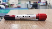 ДИАГНОЗ COVID-19 ПОДТВЕРЖДЕН У 190 ЧЕЛОВЕК