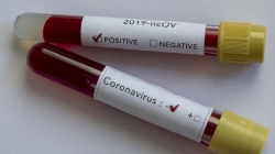 ЗА ДВОЕ СУТОК ЧЕТЫРЕ ЛЕТАЛЬНЫХ ИСХОДА ОТ COVID-19
