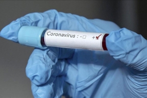 ЧЕТЫРЕ ЛЕТАЛЬНЫХ ИСХОДА ЗА СУТКИ ОТ COVID-19