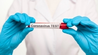 ВЫЯВЛЕНЫ ЕЩЕ 6 ЧЕЛОВЕК С COVID-19