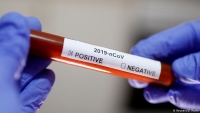 ГДЕ МОЖНО СДАТЬ ЭКСПРЕСС-ТЕСТ НА COVID-19 СТУДЕНТАМ ВЫЕЗЖАЮЩИМ НА УЧЕБУ В РОССИЮ