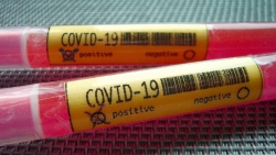 ДИАГНОЗ COVID-19 ПОДТВЕРЖДЕН У 163 ЧЕЛОВЕК